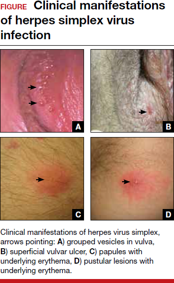 obgm0291129 fig1